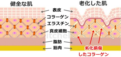 コラーゲンと老化肌
